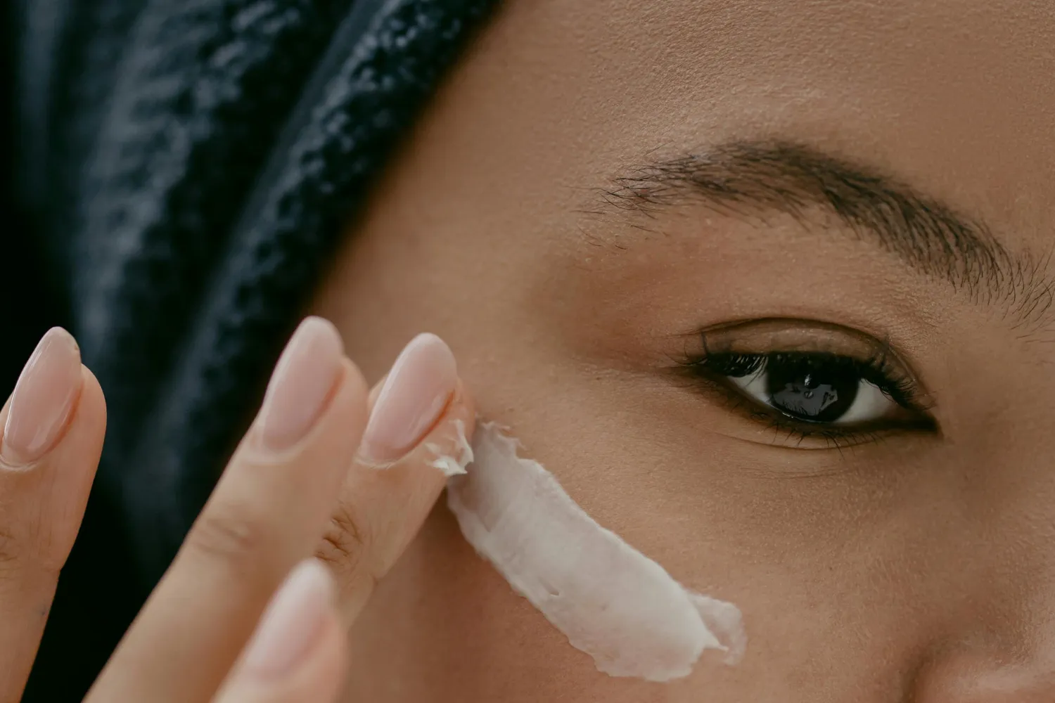 Best Eye Cream for Eczema on Eyelids That Really Works