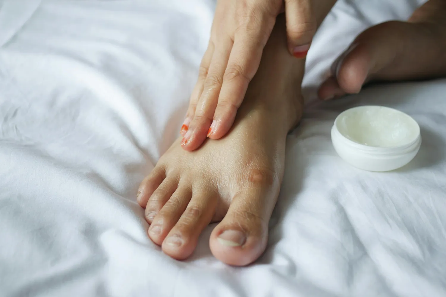Miracle Fix Best Foot Cream for Cracked Heels That Works